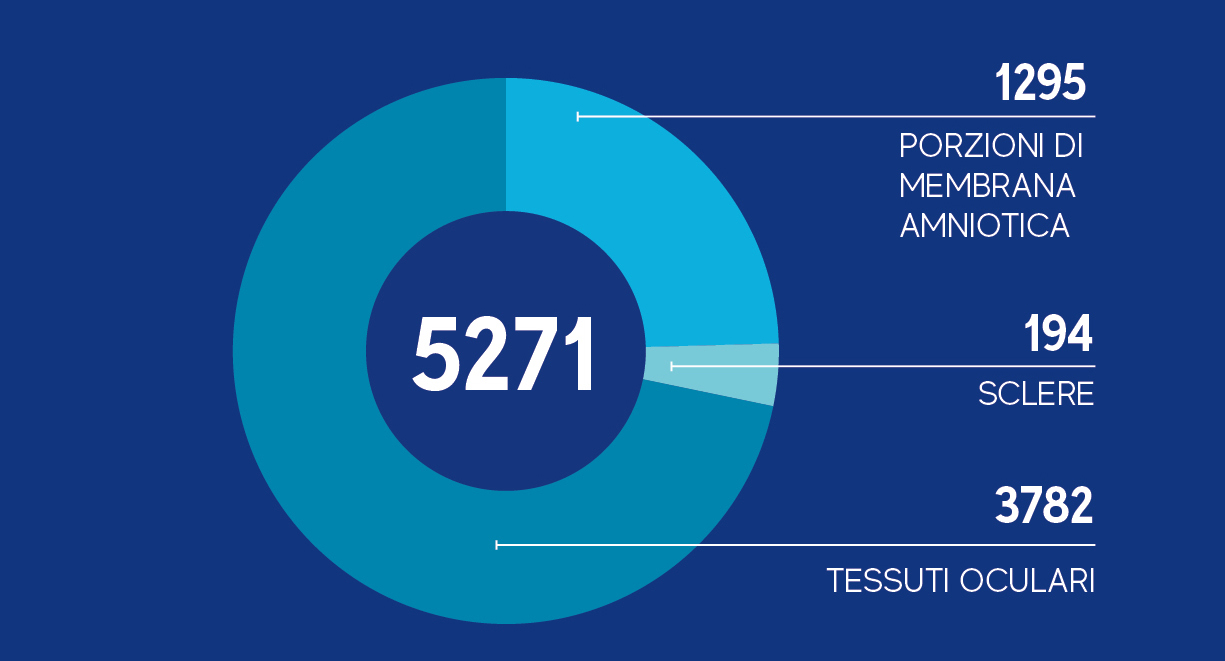 attività di distribuzione