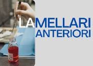 lamellari_anteriori