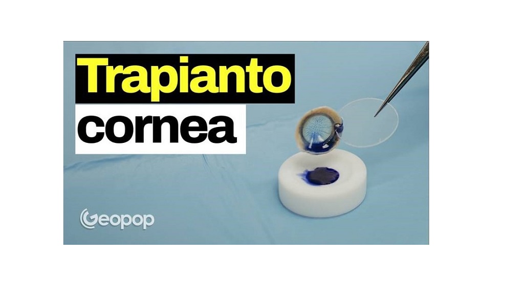 GEOPOP, il trapianto di cornea spiegato ai ragazzi